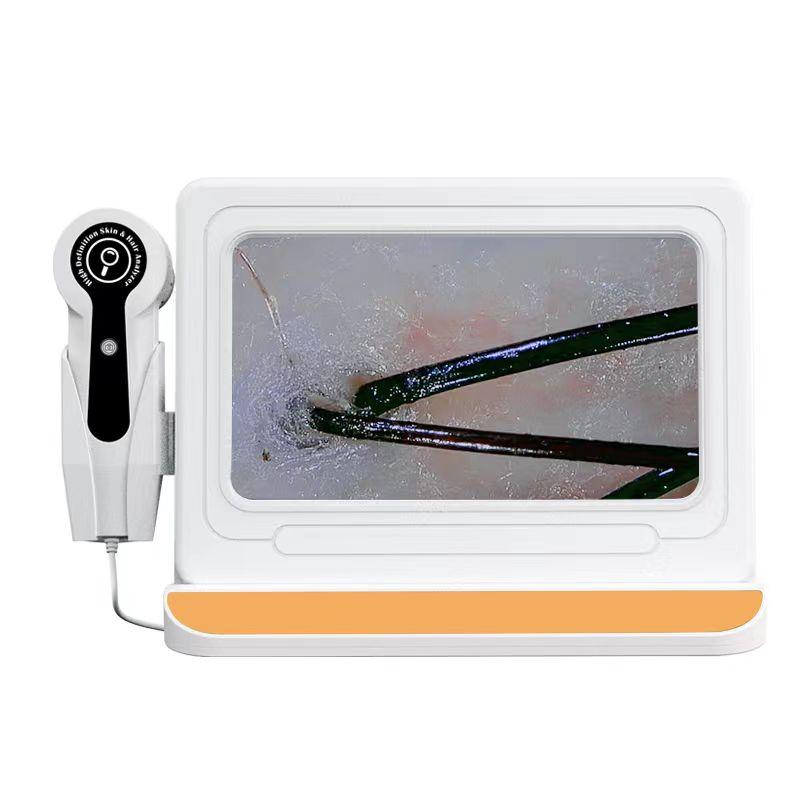 Professional Scalp Analyzer: Discover Scalp Health - Luxe Beauty