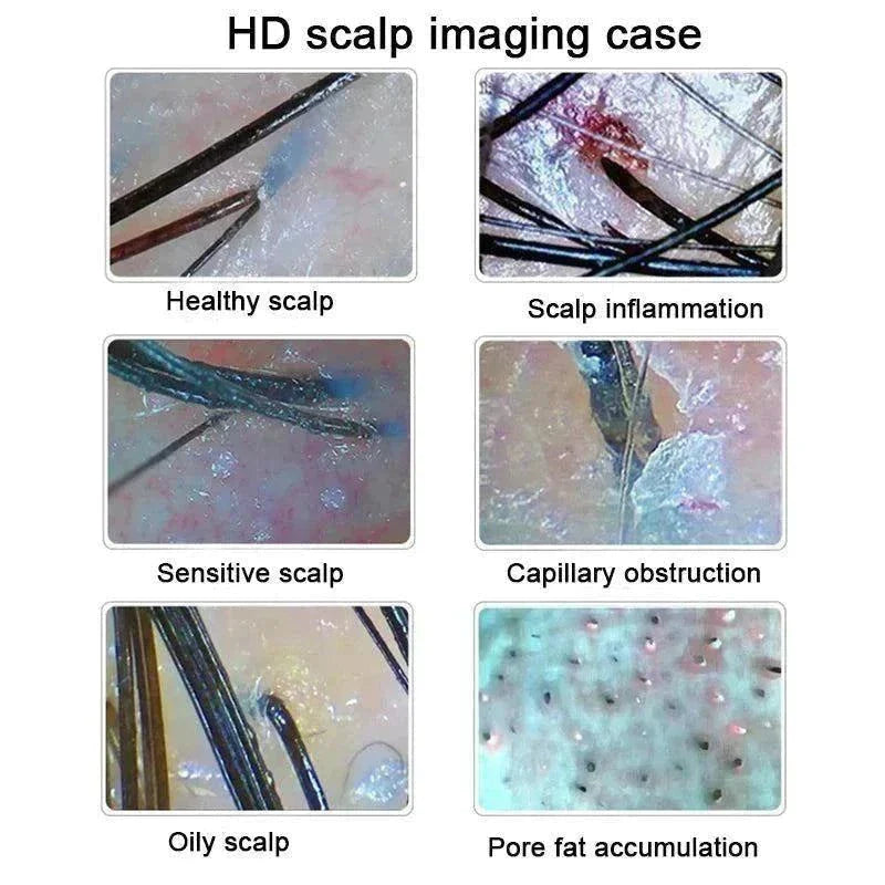 Professional Scalp Analyzer: Discover Scalp Health - Luxe Beauty