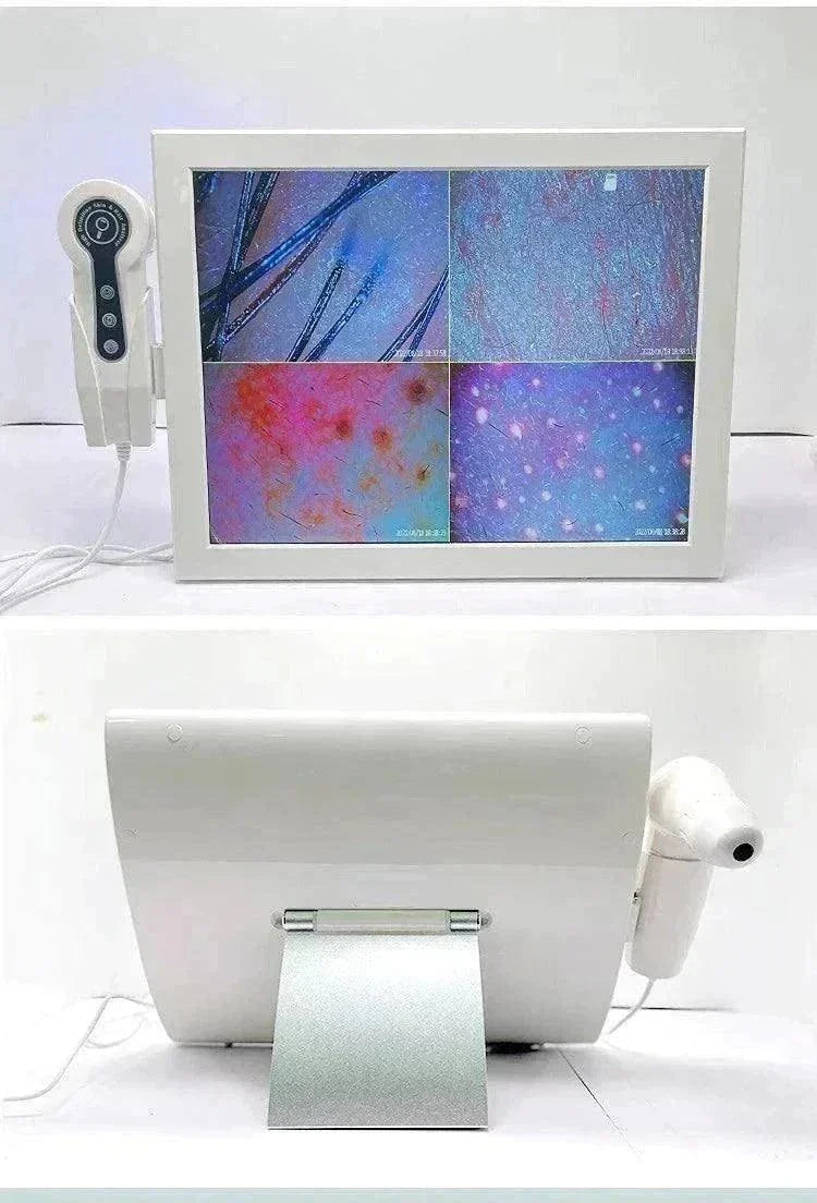 Professional Scalp Analyzer: Discover Scalp Health - Luxe Beauty