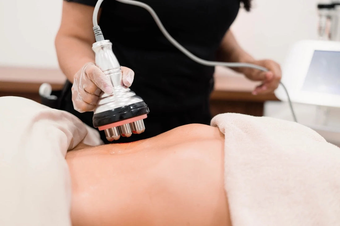 Effortless Beauty: The Ultimate Guide to Cavitation and RF Treatment