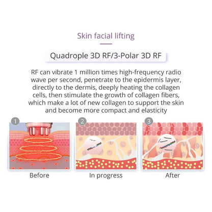 5/6 In 1 Cavitation Machine