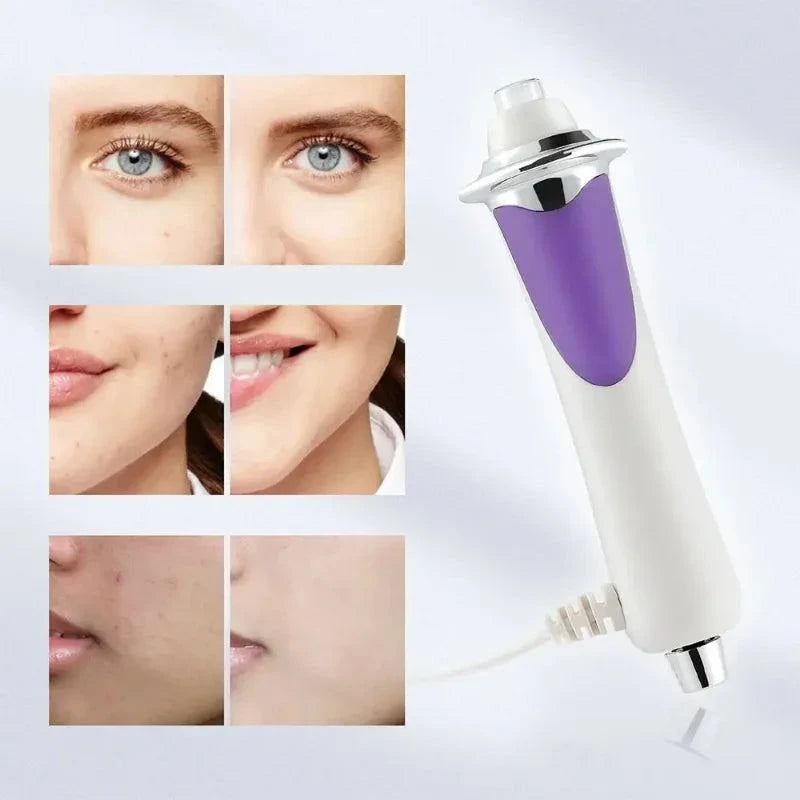 HIFU Skin Care Machine