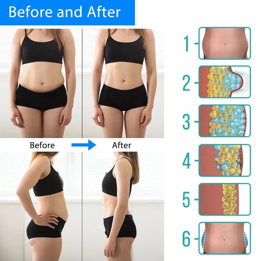 Cryolipolysis Machine