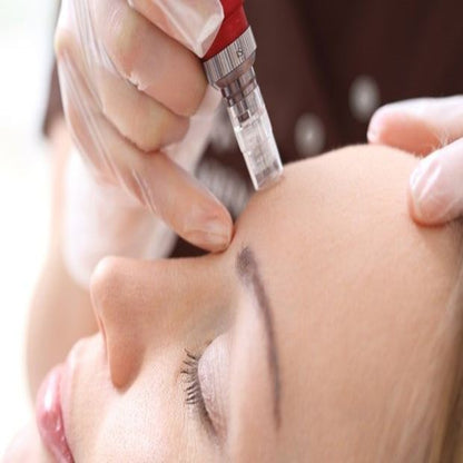 MicroNeedling Training